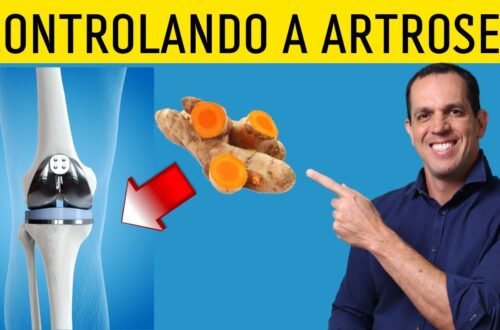 7-Dicas-Para-Quem-Sofre-com-Artrose