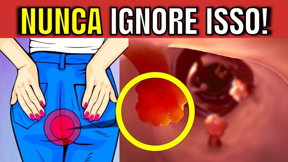 7-SINTOMAS-de-ALERTA-de-CANCER-DE-INTESTINO-que-voce-NUNCA-PODE-IGNORAR