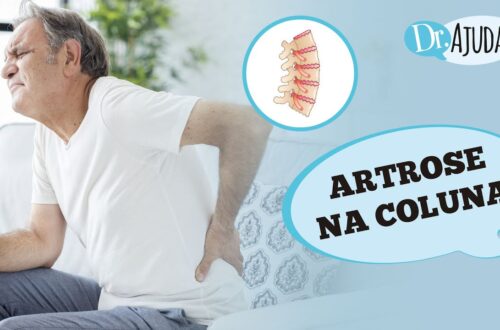 ARTROSE-NA-COLUNA-O-QUE-E-SINTOMAS-DIAGNOSTICO-E-TRATAMENTO