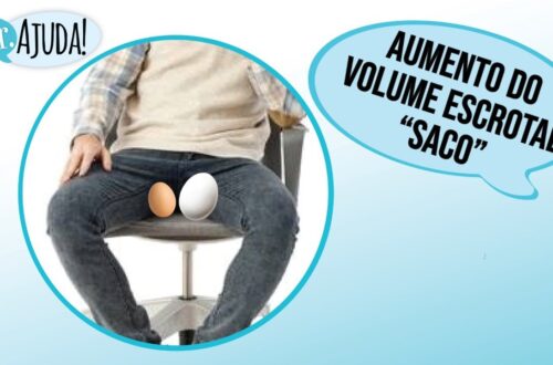 AUMENTO-DO-VOLUME-ESCROTAL-SACO-GRANDE-OU-INCHADO