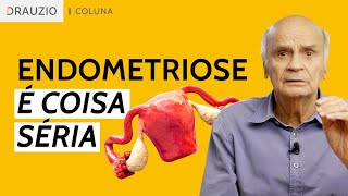 Dor-exagerada-pode-ser-endometriose