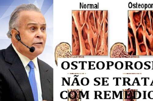 Dr-Lair-Ribeiro-COMO-VENCER-A-OSTEOPOROSE.-OSTEOPOROSE-NAO-SE-TRATA-COM-REMEDIOS-PELO-CONTRARIO