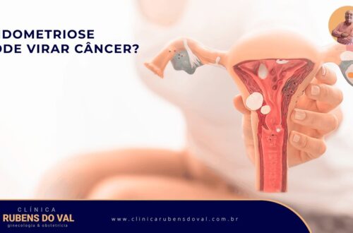 Endometriose-pode-virar-cancer-Clinica-Rubens-do-Val-CRM-58764
