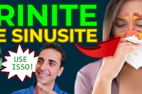 RINITE-E-SINUSITE-TRATAMENTO-NATURAL
