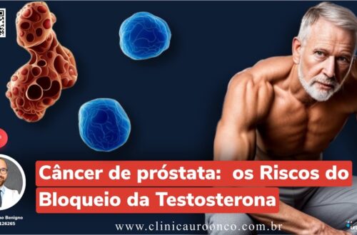 Terapia-hormonal-no-tratamento-do-cancer-de-prostata.-Os-efeitos-do-Bloqueio-da-Testosterona