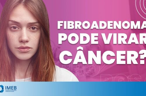 Fibroadenoma-pode-virar-Cancer-IMEB
