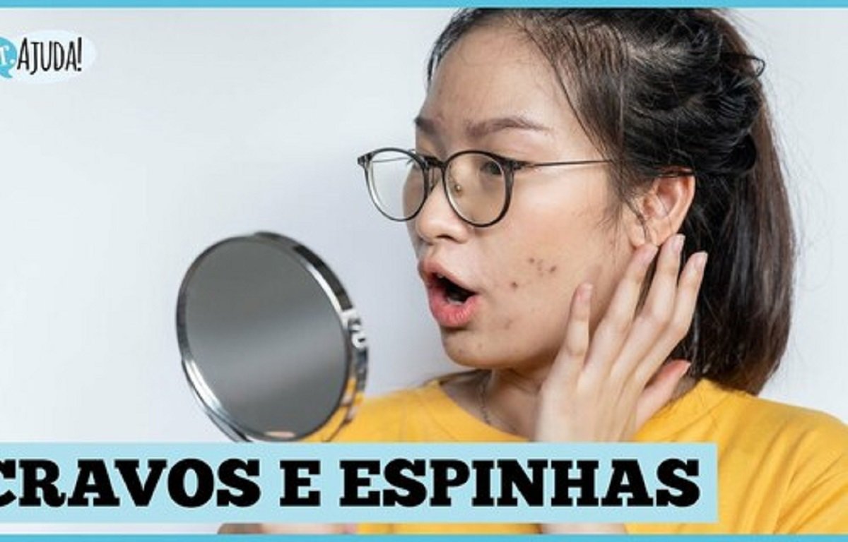 Leia mais sobre o artigo Cravos e espinhas: Quais as diferenças? O que fazer?